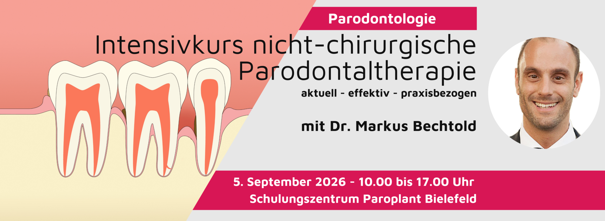 Fortbildung Intensivkurs nicht-chirurgische Parodontalchirurgie